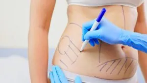 Giảm mỡ Zero Fat có nguy hiểm không? Sự thật cần biết trước khi thực hiện