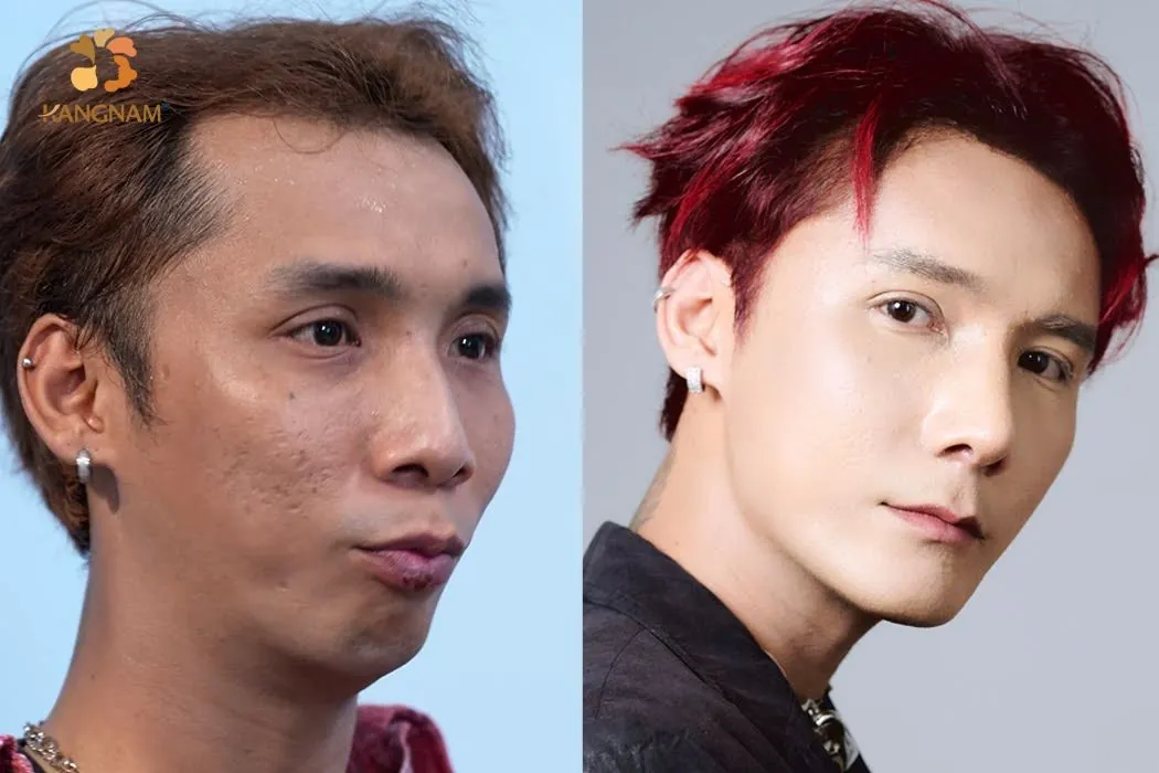 Lê Chí Nguyện mong muốn thay đổi để có ngoại hình thiện cảm hơn khi hoạt động nghệ thuật 