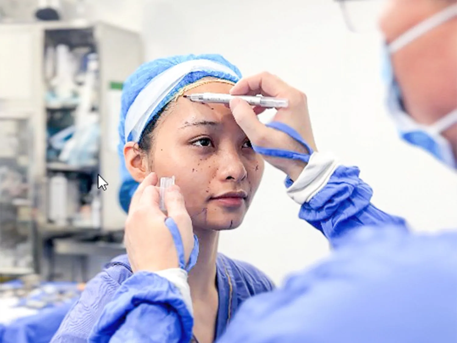 Bác sĩ phác thảo các vùng cần cấy mỡ trên gương mặt Khánh Huyền