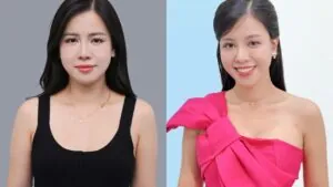 Sở hữu vòng một to tròn quyến rũ sau 10 ngày nâng ngực của ca sĩ Hoàng Yến