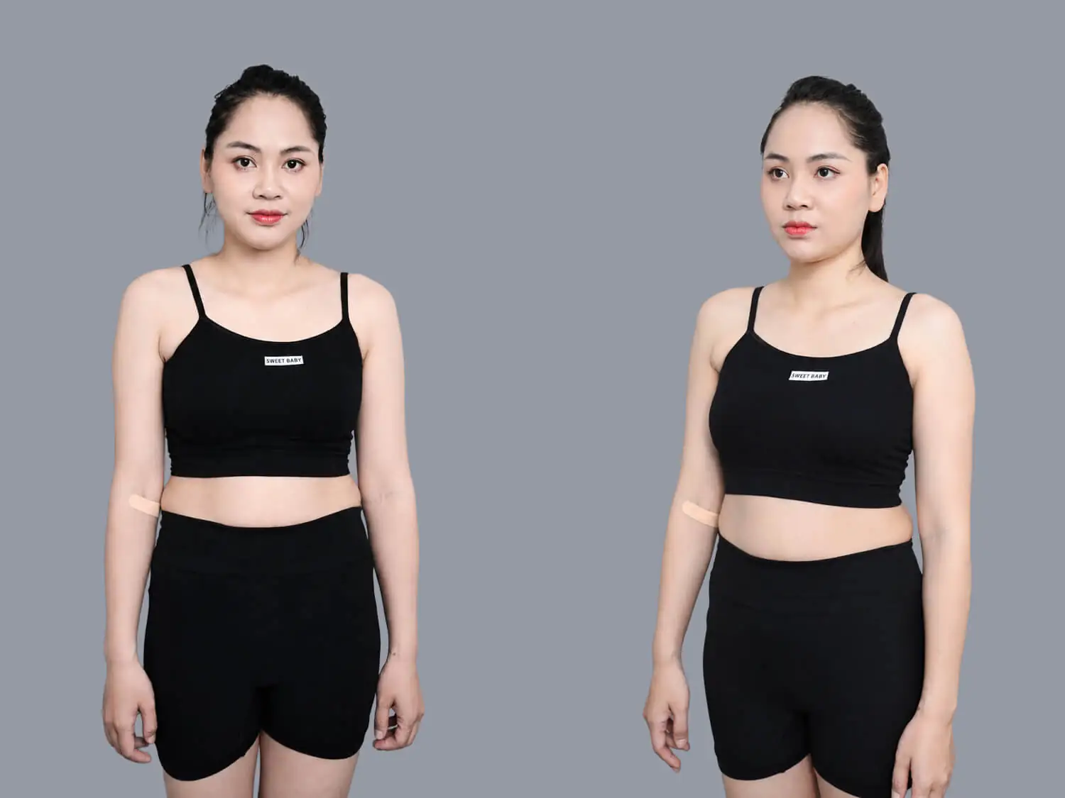 Diễn viên Nabi Hương gặp tình trạng bụng và bắp tay tích tụ nhiều mỡ thừa sau khi sinh 2 con