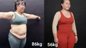 100 thoát mỡ an toàn: "mẹ siêu nhân" hạnh phúc khi loại bỏ 30 kg mỡ