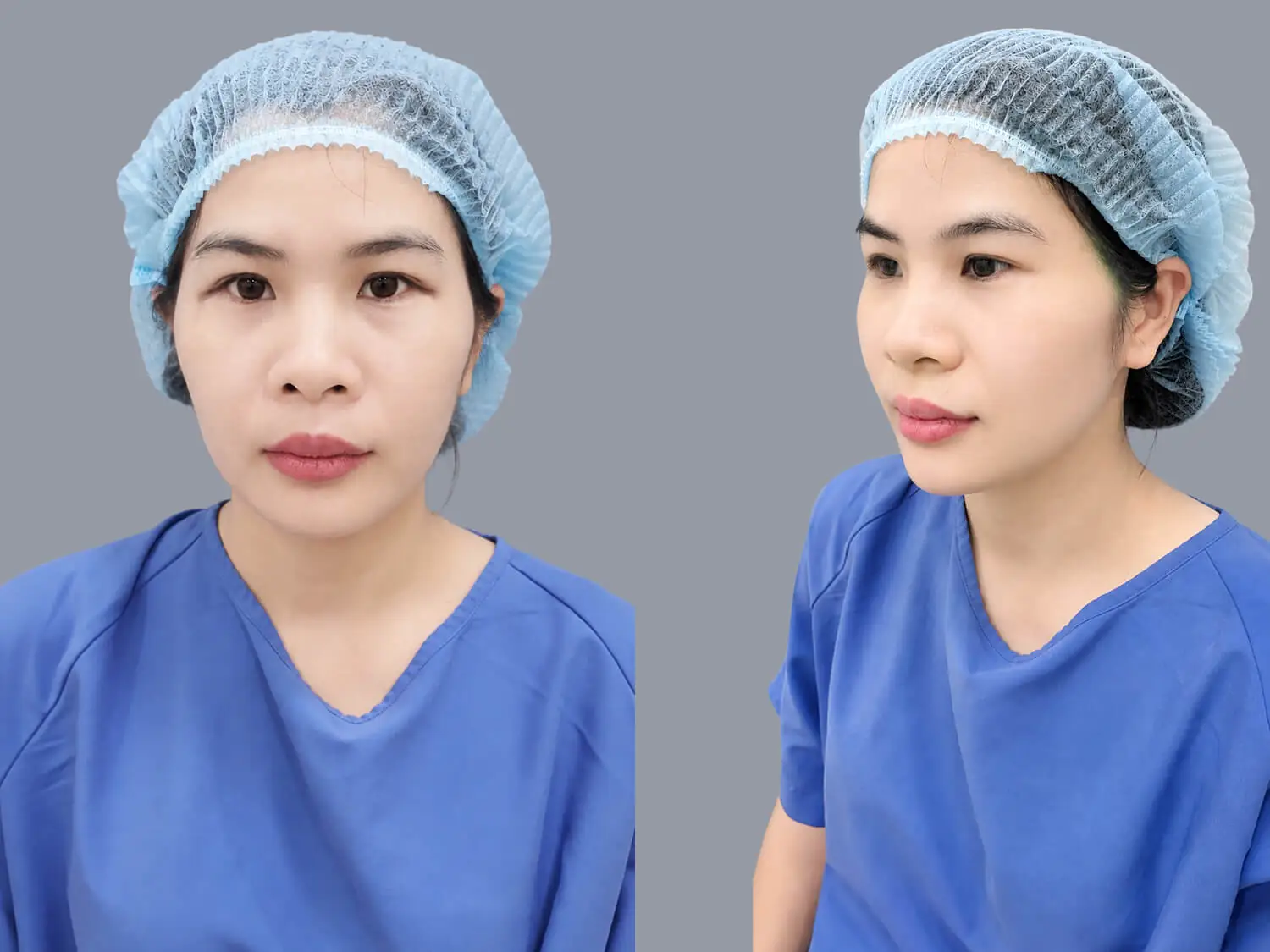 Chị Tỉnh có gương mặt hốc hác, gầy gò và khóe mắt nhiều nếp rẻ quạt