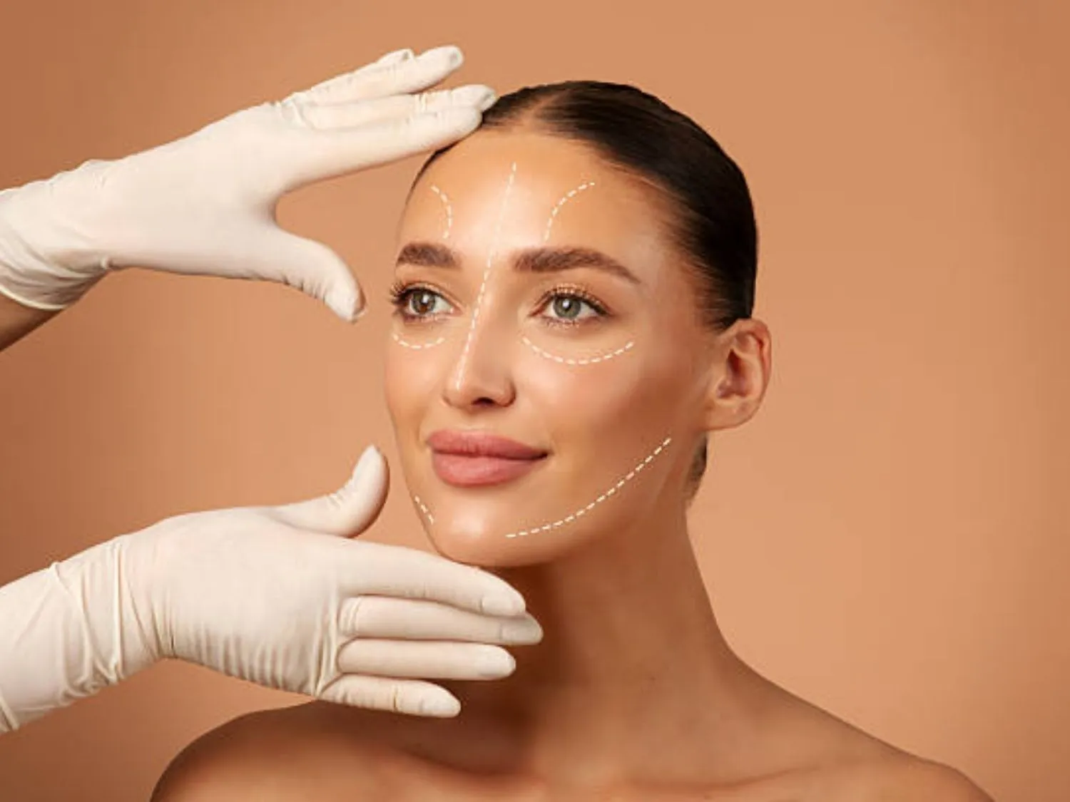 Phẫu thuật 3 điểm khuôn mặt là kỹ thuật đại phẫu can thiệp vào 3 vùng xương trọng yếu trên gương mặt, loại bỏ nét góc cạnh, thô cứng, biến gương mặt vuông