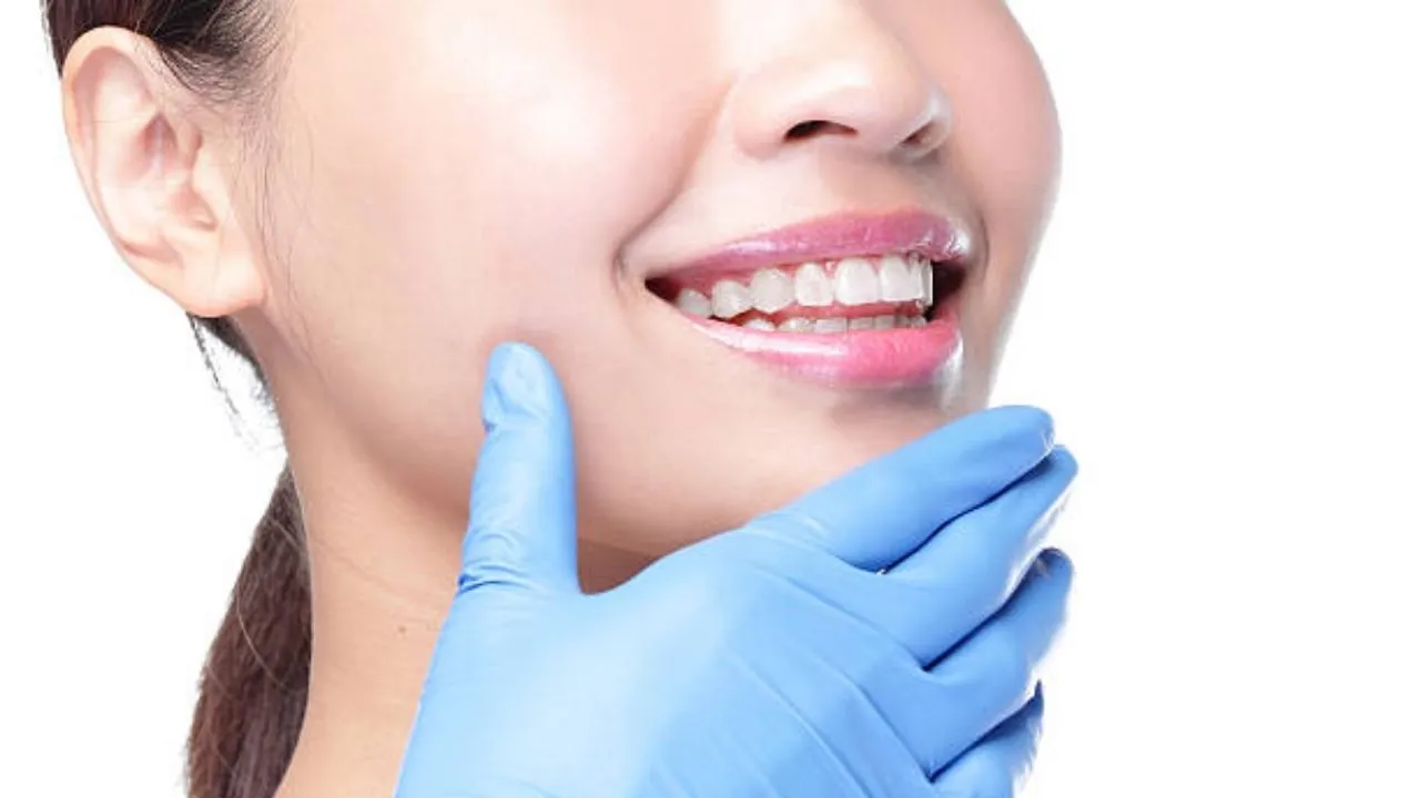 Phẫu thuật hàm hô không niềng răng là kỹ thuật ngoại khoa can thiệp trực tiếp vào khung xương hàm đẩy lùi khối hàm bị nhô về vị trí chuẩn khớp cắn