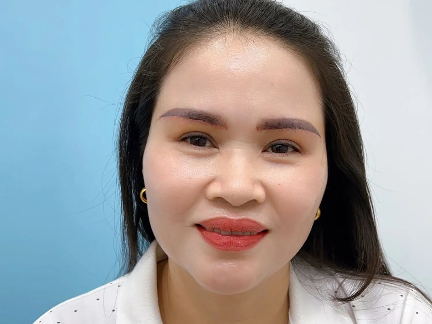 Tái khám theo lịch hẹn của bác sĩ để kiểm tra tốc độ phục hồi vết thương sau treo chân mày