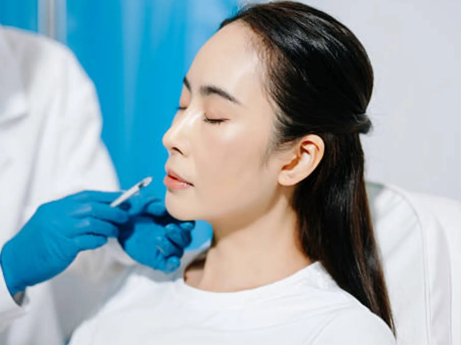 các điểm tiêm chính gồm gò má, gờ mũi, cằm, hàm...