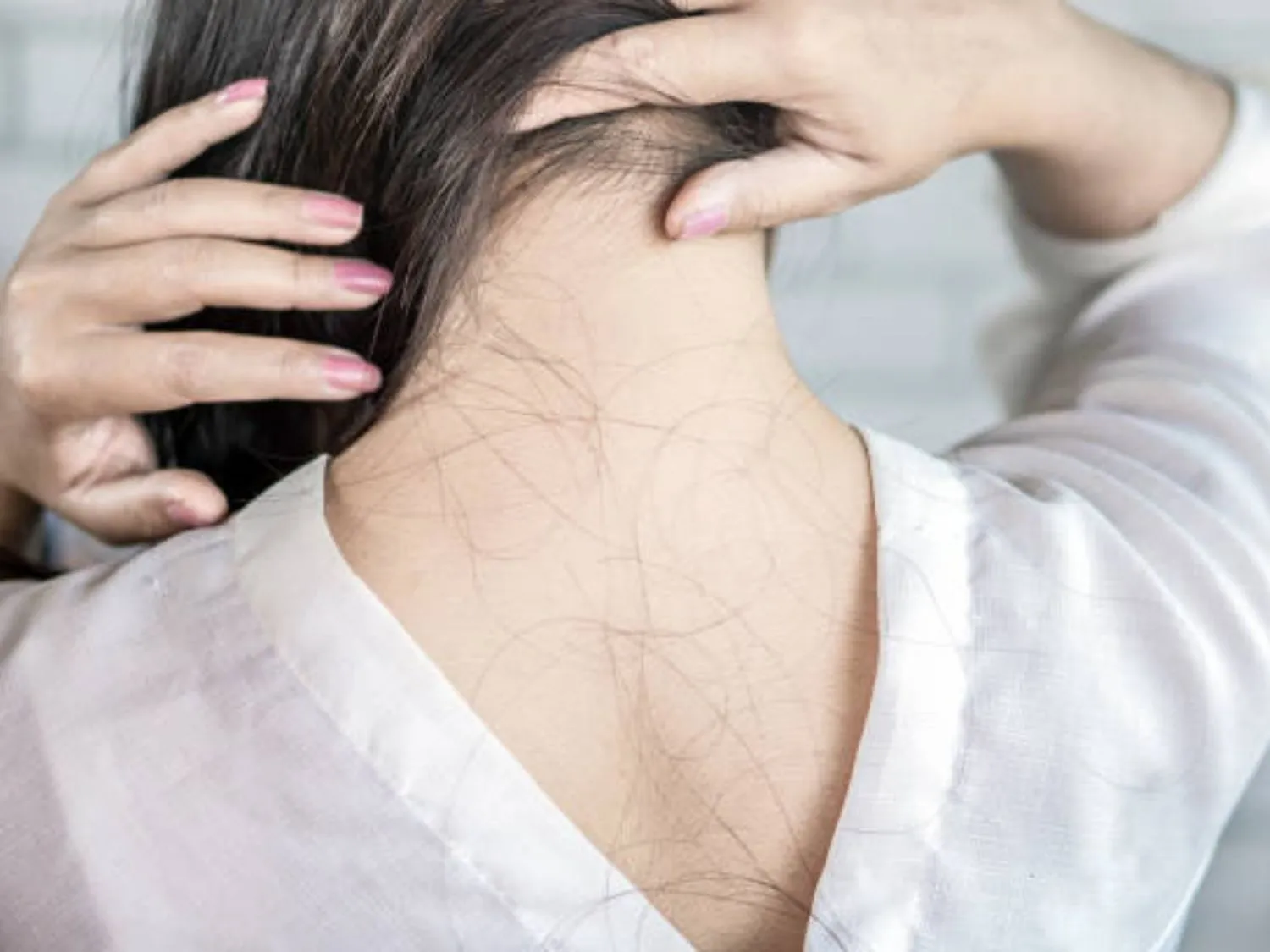 rụng lượng tóc nhiều, dai dẳng và trong thời gian dài cần thăm khám sớm