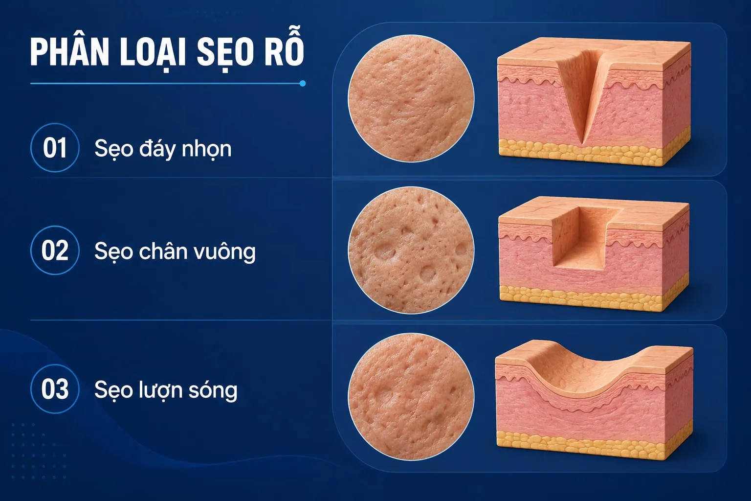 ảnh phân loại sẹo rỗ