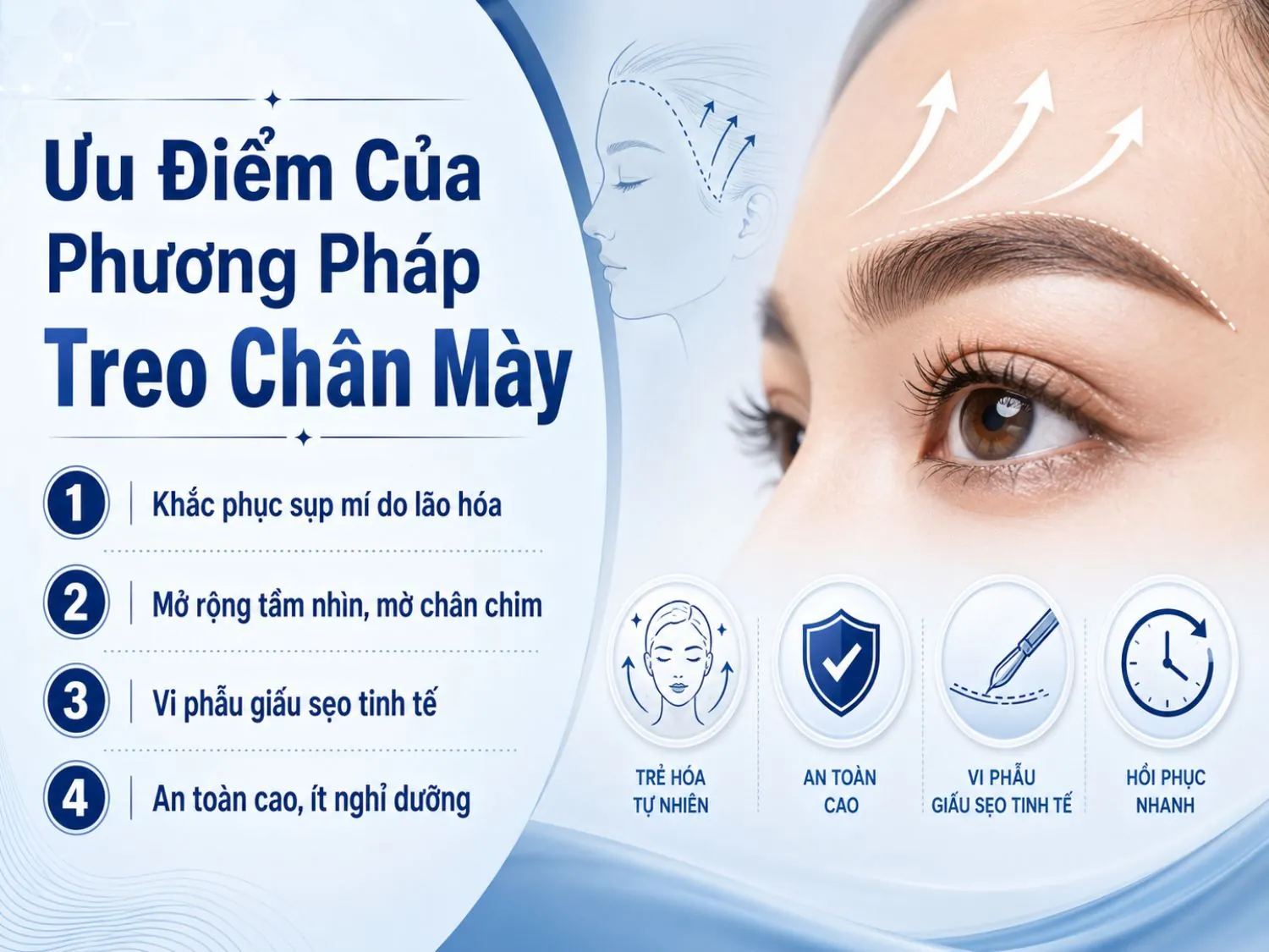 Treo chân mày là phương pháp hỗ trợ cải thiện sụp mí do lão hóa, giúp vùng mắt trông mở hơn, làm mờ nếp chân chim, giấu sẹo khéo léo và rút ngắn thời gian nghỉ dưỡng.