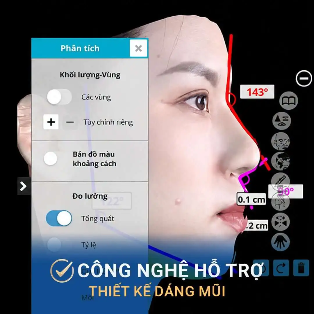 Công nghệ mô phỏng hỗ trợ phân tích các thông số khuôn mặt và dáng mũi, giúp bác sĩ tham khảo khi xây dựng phương án phẫu thuật.