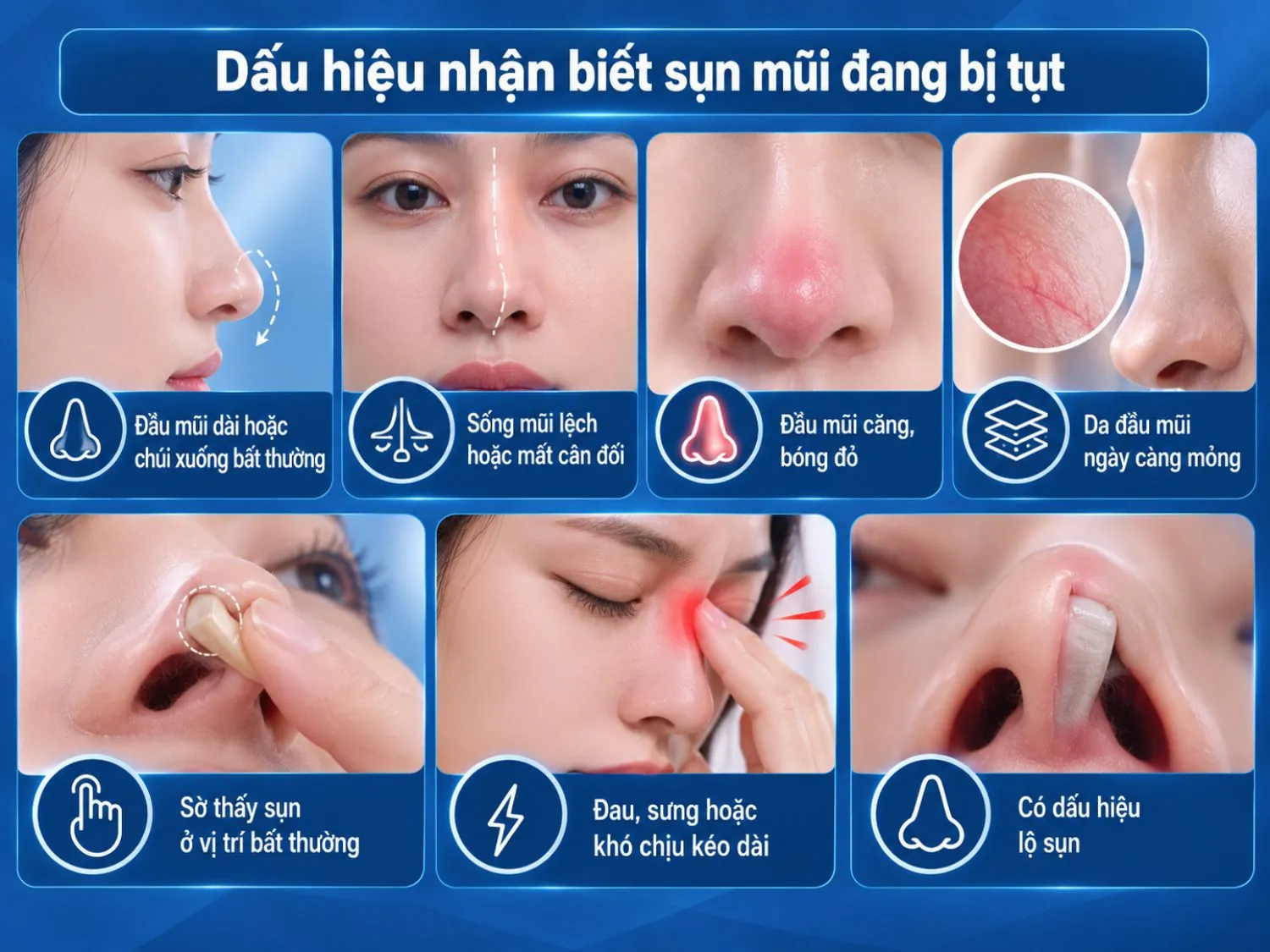 Các dấu hiệu cảnh báo có thể gồm đầu mũi chúi xuống, sống mũi lệch, da đầu mũi căng bóng hoặc mỏng dần, sờ thấy sụn bất thường, đau kéo dài hay có dấu hiệu lộ sụn.