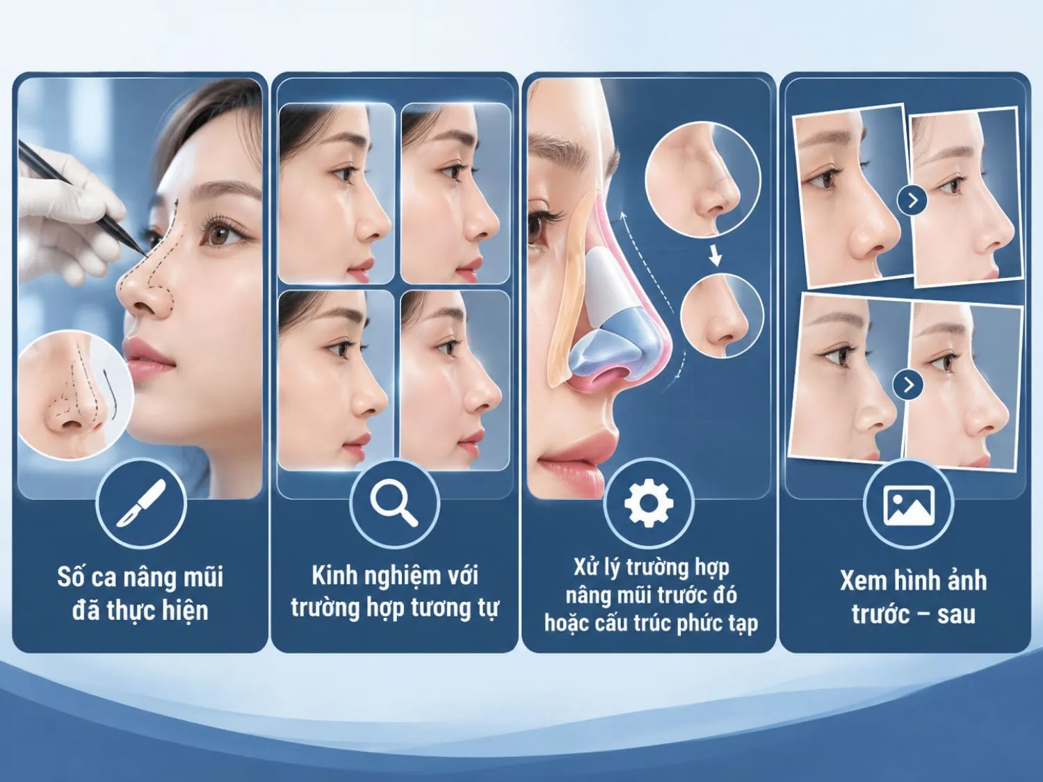 Khi tư vấn nâng mũi, nên tìm hiểu số ca bác sĩ đã thực hiện, kinh nghiệm xử lý cấu trúc tương tự và hình ảnh trước – sau của khách hàng.