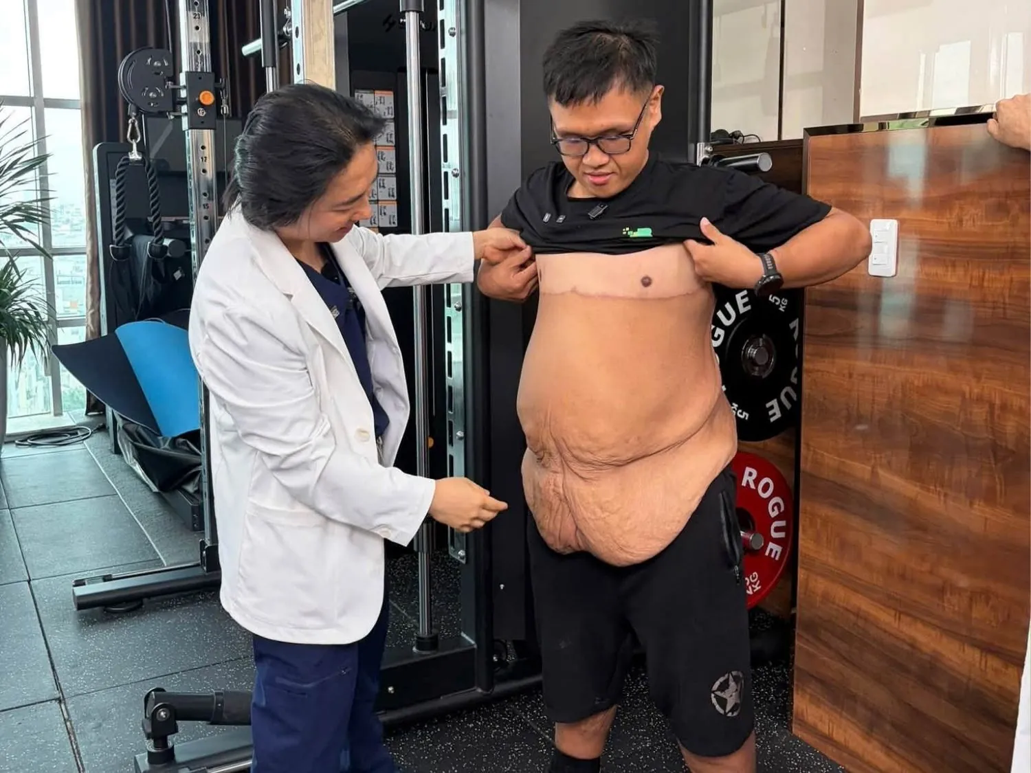 Dr. Richard Huy nhận định về tình trạng da thừa còn lại