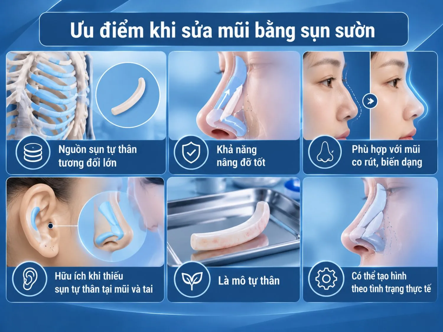 Sụn sườn cung cấp nguồn mô tự thân tương đối lớn, khả năng nâng đỡ tốt và có thể tạo hình phù hợp với cấu trúc mũi cần chỉnh sửa.